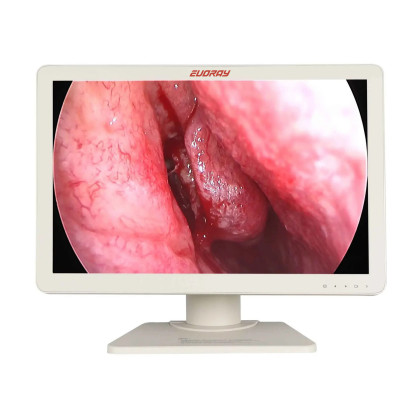Монитор 27” Full HD эндоскопический-хирургический EVORAY S271P Фото товара Монитор 27” Full HD эндоскопический-хирургический EVORAY S271P
