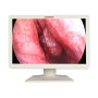 Монитор 27” Full HD эндоскопический-хирургический EVORAY S271P Фото товара Монитор 27” Full HD эндоскопический-хирургический EVORAY S271P