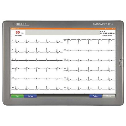 Электрокардиограф SCHILLER CARDIOVIT MS-2015 Фото товара Электрокардиограф SCHILLER CARDIOVIT MS-2015
