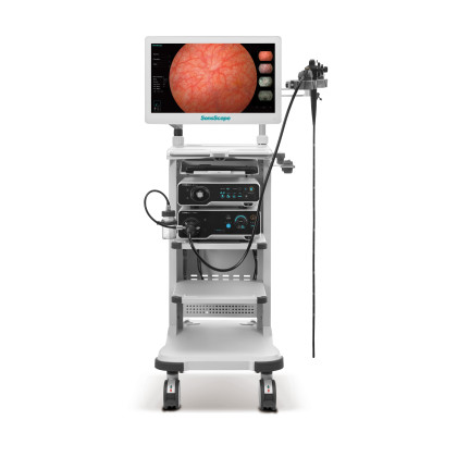 SonoScape HD-550 видеоэндоскопическая система Фото товара SonoScape HD-550 видеоэндоскопическая система