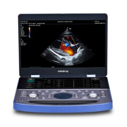 Ветеринарный УЗИ-сканер Mindray Vetus E7 Фото товара Ветеринарный УЗИ-сканер Mindray Vetus E7