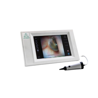 Фото товара Видеоотоскоп ОПТИMED В0-01