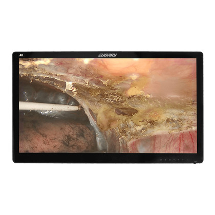 Монитор 32" 4K эндоскопический-хирургический  EVORAY S3281P Фото товара Монитор 32" 4K эндоскопический-хирургический  EVORAY S3281P