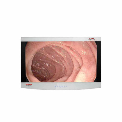 Фото товара Монитор NDS Radiance Ultra 27"