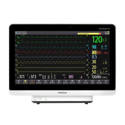 Фото товара Монитор пациента Mindray BeneVision N17