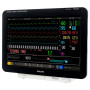 Фото товара Монитор пациента Philips IntelliVue MX800