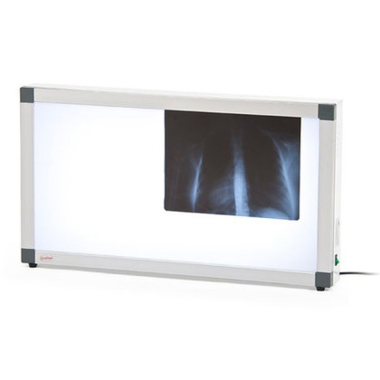 Негатоскоп общего назначения Армед 2-х кадровый Фото товара Негатоскоп общего назначения Армед 2-х кадровый