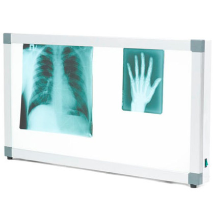 Негатоскоп общего назначения Армед 2-х кадровый Фото товара Негатоскоп общего назначения Армед 2-х кадровый