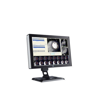 ПО для магнитно-резонансного анализа желудочков Esaote CAAS MRV Фото товара ПО для магнитно-резонансного анализа желудочков Esaote CAAS MRV