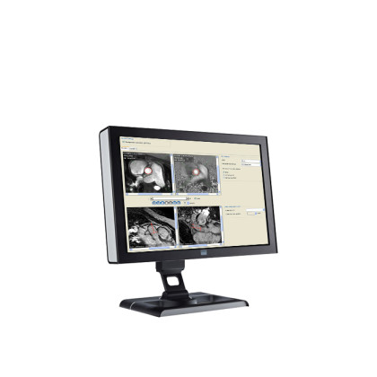 ПО для магнитно-резонансного анализа кровотока Esaote CAAS MR Flow Фото товара ПО для магнитно-резонансного анализа кровотока Esaote CAAS MR Flow