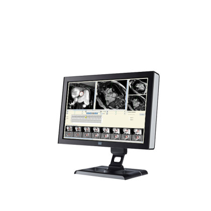 ПО для магнитно-резонансного анализа кровотока Esaote CAAS MR Flow Фото товара ПО для магнитно-резонансного анализа кровотока Esaote CAAS MR Flow