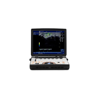 Портативная ультразвуковая система GE Healthcare LOGIQ E Фото товара Портативная ультразвуковая система GE Healthcare LOGIQ E