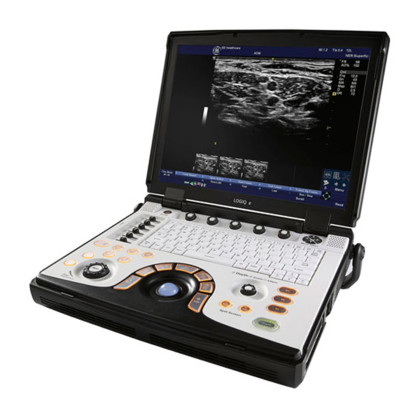 Портативная ультразвуковая система GE Healthcare LOGIQ E Фото товара Портативная ультразвуковая система GE Healthcare LOGIQ E