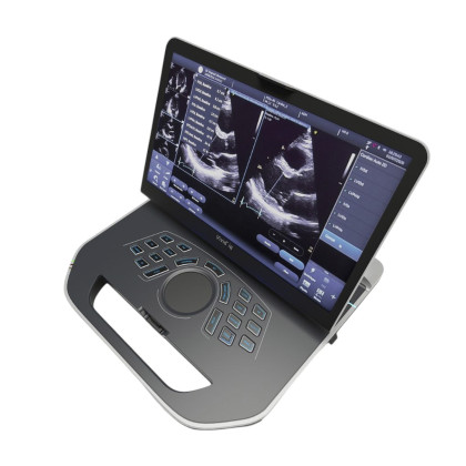 Портативная ультразвуковая система GE Healthcare Vivid iQ Фото товара Портативная ультразвуковая система GE Healthcare Vivid iQ