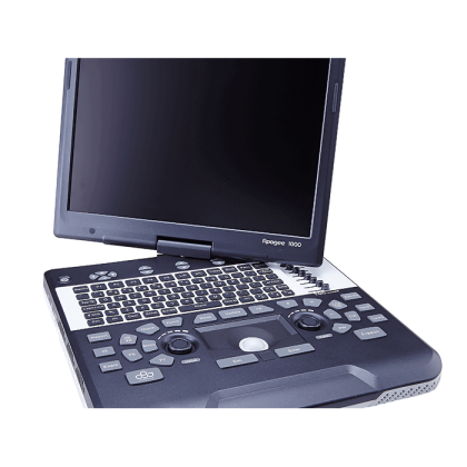 Портативная ультразвуковая система SIUI Apogee 1100 Diamond Фото товара Портативная ультразвуковая система SIUI Apogee 1100 Diamond