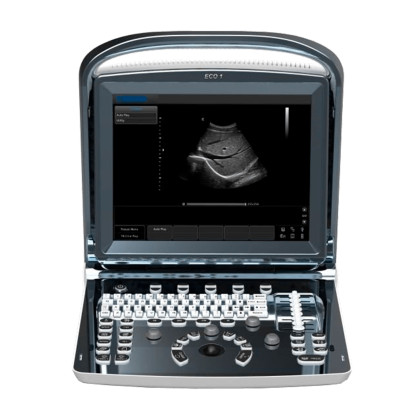 Портативный УЗИ аппарат Chison SonoTouch 20 Фото товара Портативный УЗИ аппарат Chison SonoTouch 20