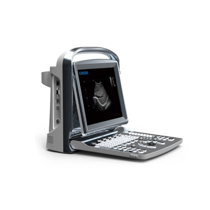 Портативный УЗИ аппарат Chison SonoTouch 20 Фото товара Портативный УЗИ аппарат Chison SonoTouch 20