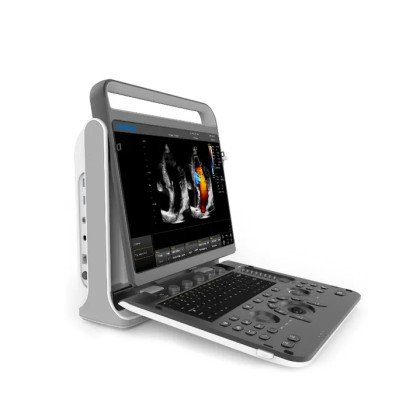 Портативный УЗИ аппарат Chison SonoTouch 60 Pro Фото товара Портативный УЗИ аппарат Chison SonoTouch 60 Pro