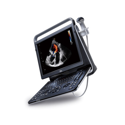 Портативный УЗИ аппарат Chison SonoTouch 60 Фото товара Портативный УЗИ аппарат Chison SonoTouch 60