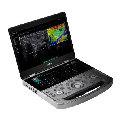 Фото товара Портативный УЗИ аппарат Mindray MX8 Exp