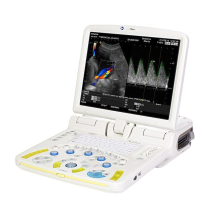 Портативный ультразвуковой сканер Hitachi Noblus Фото товара Портативный ультразвуковой сканер Hitachi Noblus