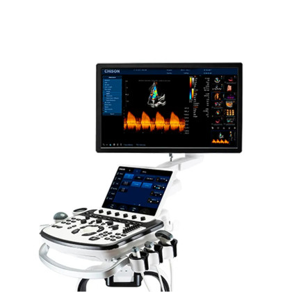 Фото товара Стационарный УЗИ аппарат Chison Qbit 12 (XBit 90)