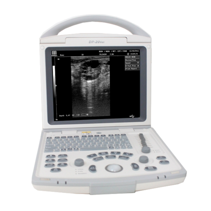 УЗ система Mindray DP-20 Фото товара УЗ система Mindray DP-20