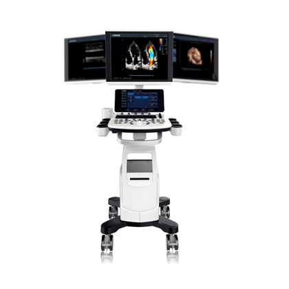 УЗИ аппарат CHISON CBit 6 Фото товара УЗИ аппарат CHISON CBit 6