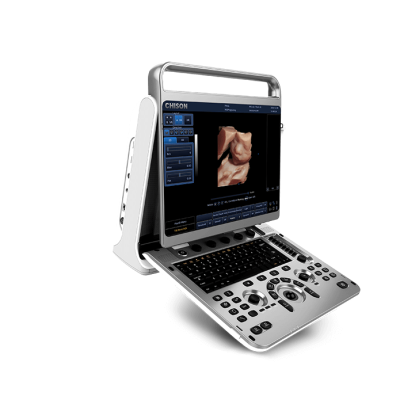УЗИ аппарат CHISON EBit 30 Фото товара УЗИ аппарат CHISON EBit 30