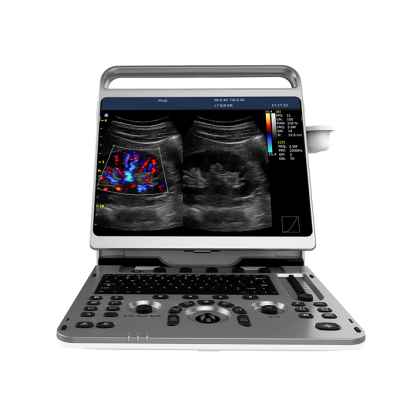 Фото товара УЗИ аппарат CHISON EBit 50