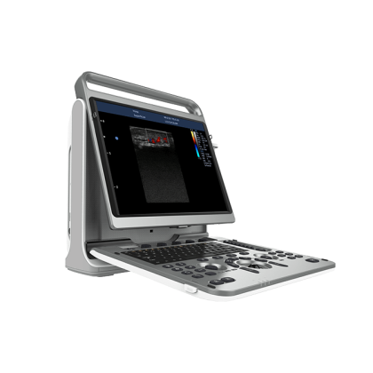 Фото товара УЗИ аппарат CHISON EBit 50