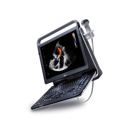 УЗИ аппарат CHISON EBit 60 Фото товара УЗИ аппарат CHISON EBit 60