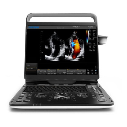 УЗИ аппарат CHISON EBit 60 Фото товара УЗИ аппарат CHISON EBit 60