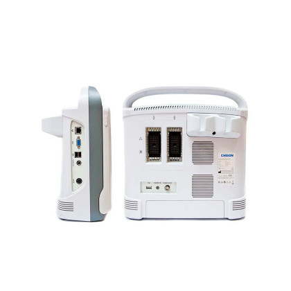 УЗИ аппарат CHISON ECO 1 Фото товара УЗИ аппарат CHISON ECO 1