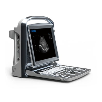 УЗИ аппарат CHISON ECO 1 Фото товара УЗИ аппарат CHISON ECO 1