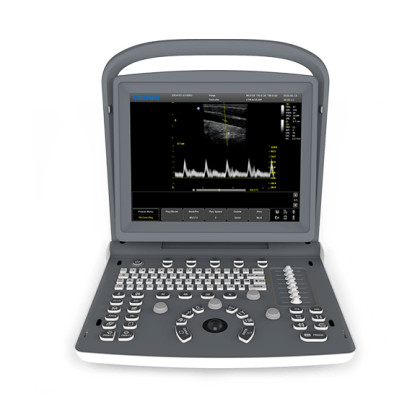 УЗИ аппарат CHISON ECO 2 Фото товара УЗИ аппарат CHISON ECO 2