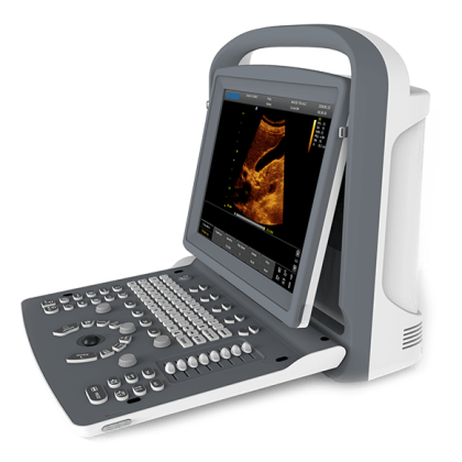 УЗИ аппарат CHISON ECO 2 Фото товара УЗИ аппарат CHISON ECO 2