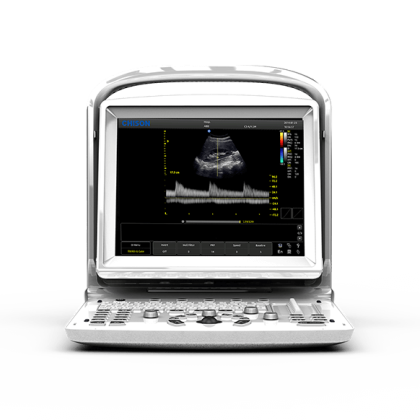 УЗИ аппарат CHISON ECO 3 Expert Фото товара УЗИ аппарат CHISON ECO 3 Expert