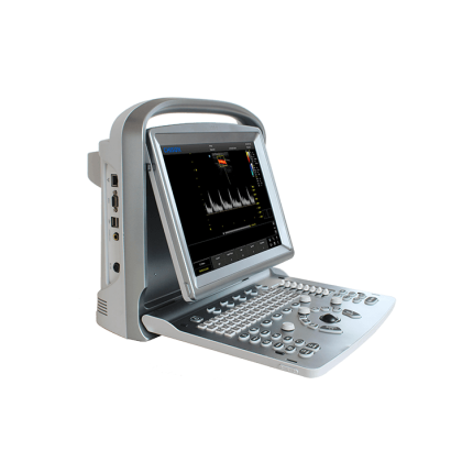 УЗИ аппарат CHISON ECO 5 Фото товара УЗИ аппарат CHISON ECO 5