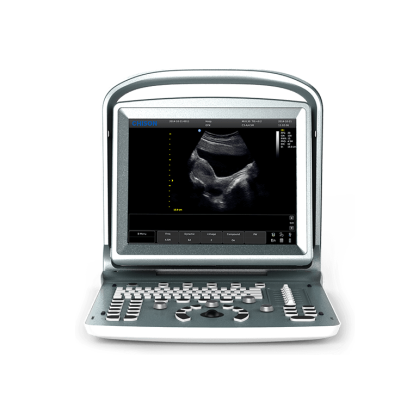 УЗИ аппарат CHISON ECO 5 Фото товара УЗИ аппарат CHISON ECO 5