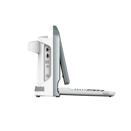 УЗИ аппарат CHISON ECO 5 Фото товара УЗИ аппарат CHISON ECO 5