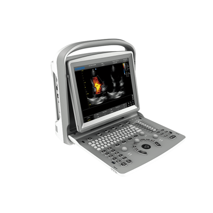 УЗИ аппарат CHISON ECO 6 Фото товара УЗИ аппарат CHISON ECO 6