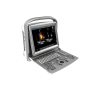 УЗИ аппарат CHISON ECO 6 Фото товара УЗИ аппарат CHISON ECO 6