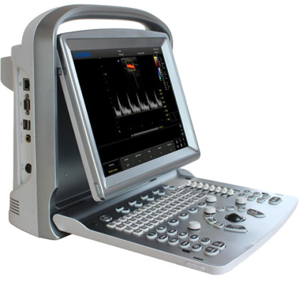 УЗИ аппарат Chison SonoTouch 50 Фото товара УЗИ аппарат Chison SonoTouch 50