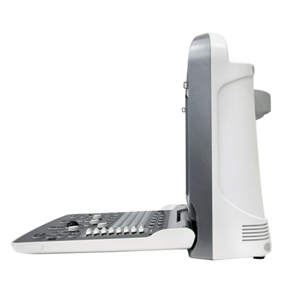 УЗИ аппарат Chison SonoTouch 50 Фото товара УЗИ аппарат Chison SonoTouch 50