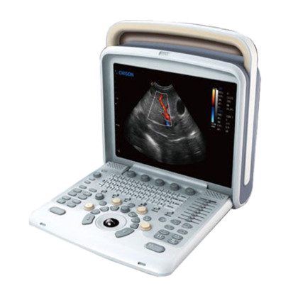 УЗИ аппарат Chison SonoTouch 50 Фото товара УЗИ аппарат Chison SonoTouch 50