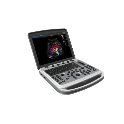 Фото товара УЗИ аппарат Chison SonoTouch 80 (SonoBook 6)