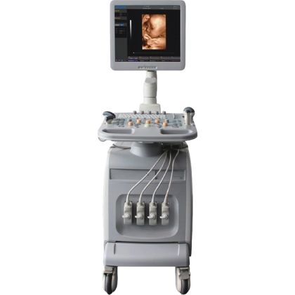 УЗИ аппарат Chison i3 Фото товара УЗИ аппарат Chison i3