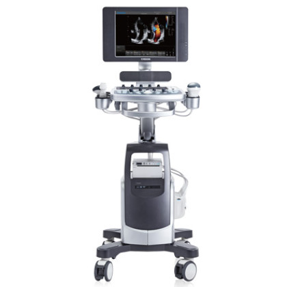 УЗИ аппарат Chison i6 Фото товара УЗИ аппарат Chison i6