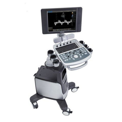 УЗИ аппарат Chison i6 Фото товара УЗИ аппарат Chison i6